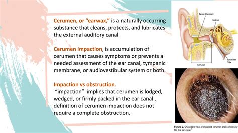 cerumen impaction tests diagnosis|occluded cerumen vs impacted.